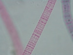 MISSING THUMBNAIL